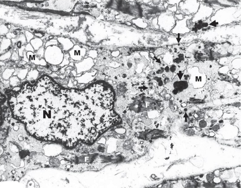 Graphic - Oxidative stress: IOL Cell