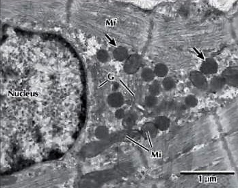 Graphic - Oxidative stress: Normal Cell